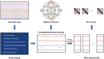 Alterations in electroencephalographic functional connectivity in individuals with major depressive disorder: a resting-state electroencephalogram study